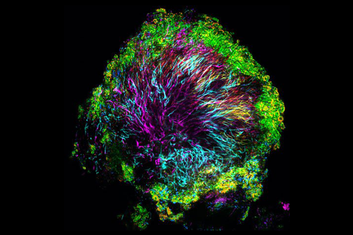 Open Wide: Human Mouth Bacteria Reproduce through Rare Form of